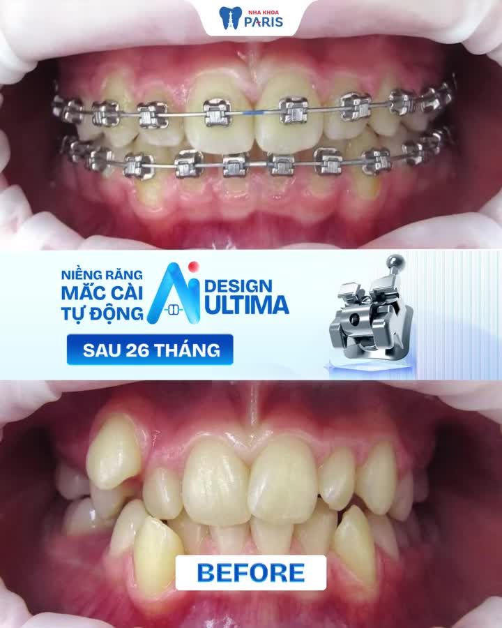 XEM NGAY MÀN "KIẾN TẠO" NỤ CƯỜI DIỆU KỲ SAU 26 THÁNG!