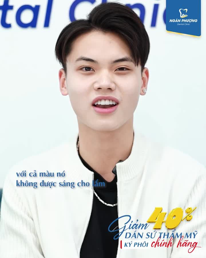 Không mài mà vẫn có răng đẹp? Tham khảo ngay Veneer nhé các bác ơi
