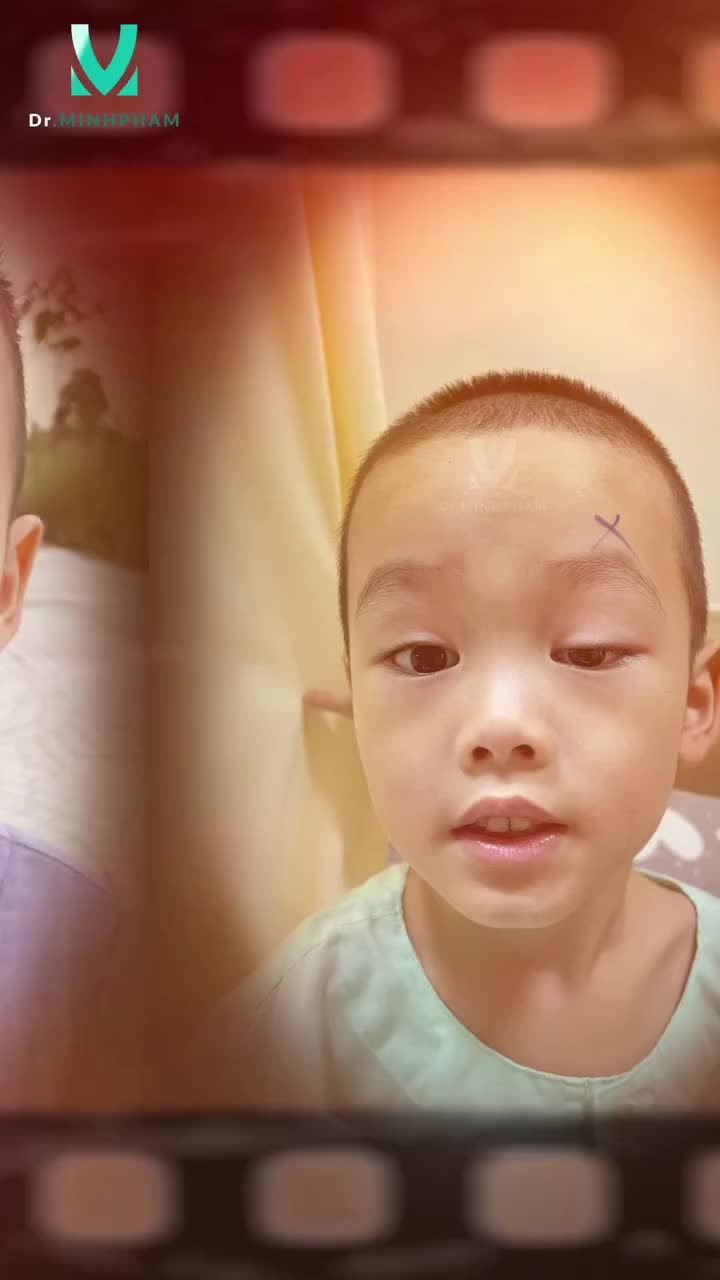  Một ca phẫu thuật nhỏ, nhưng mở ra cho con tầm nhìn sáng rõ và ánh mắt tự tin hơn trong tương lai.