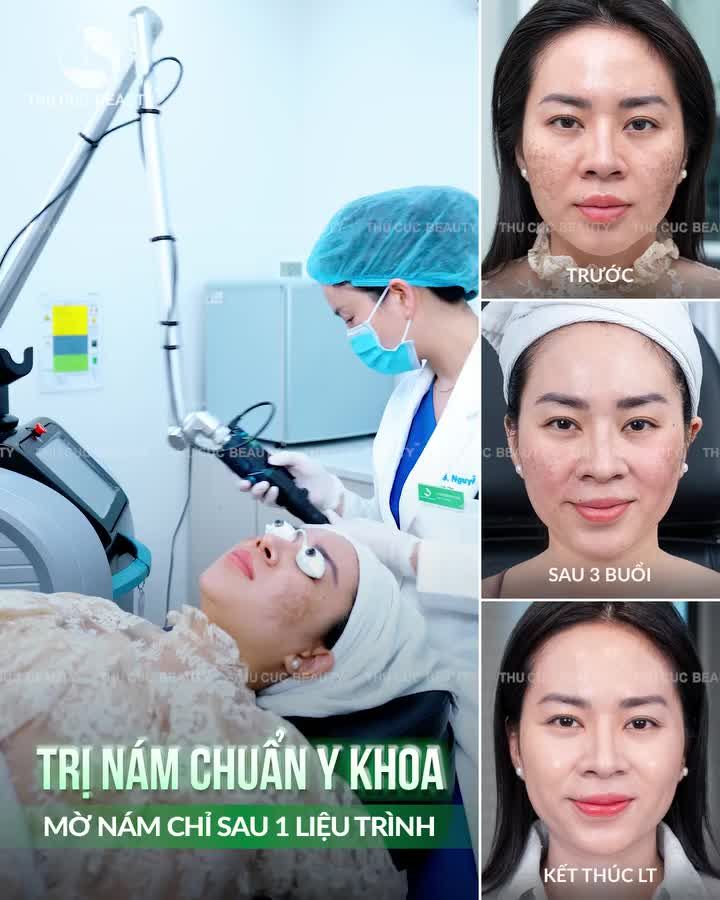 Nám lâu năm tưởng “hết cứu”?