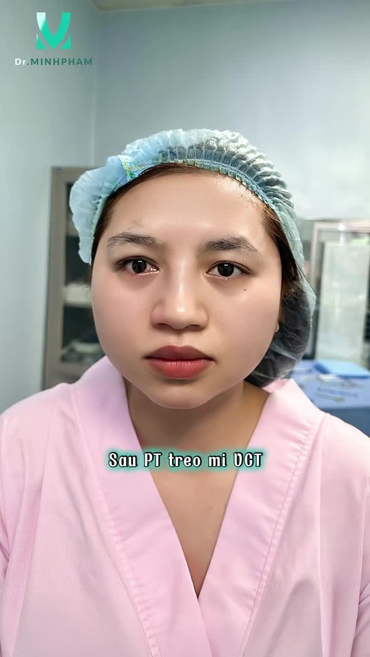 Không chỉ cải thiện tình trạng sụp mi cho khách hàng
