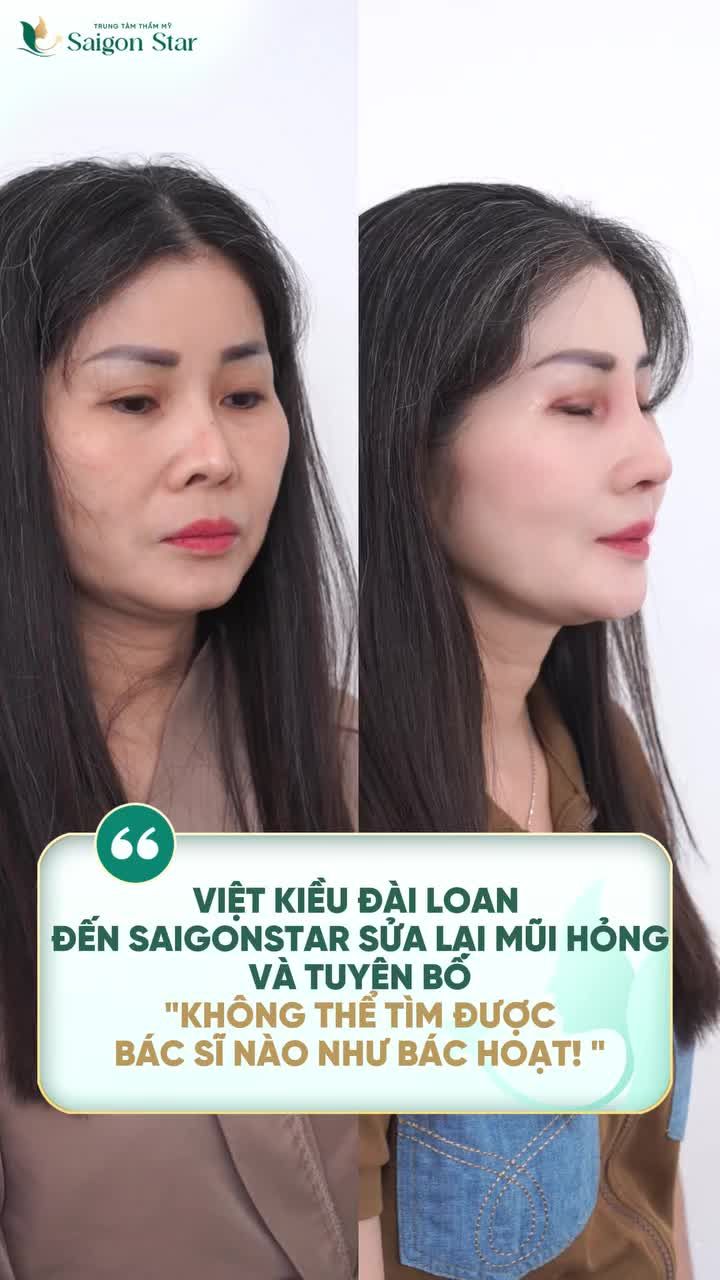 CHỊ WANG HSIAO (ĐÀI LOAN) NHẬN XÉT SAU KHI ĐƯỢC BÁC SĨ HOẠT GIẢI CỨU THÀNH CÔNG MŨI HỎNG - MÍ LỖI