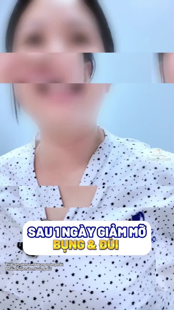 Sau 1 ngày giảm mỡ bụng đùi khách yêu nhà Gangwhoo đã tung tăng, đi lại thoải mái như này rồi nè..