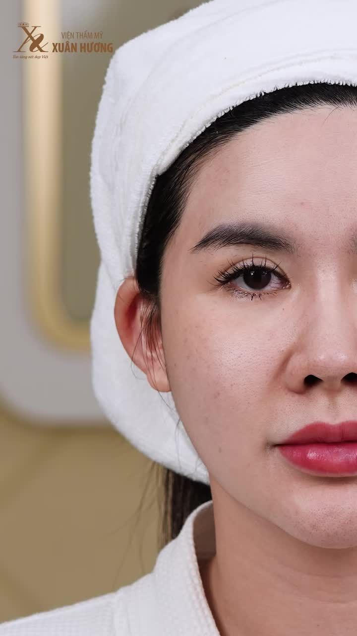DEEP CLEANING - GIẢI CỨU LÀN DA TRONG MÙA HÈ NÀY