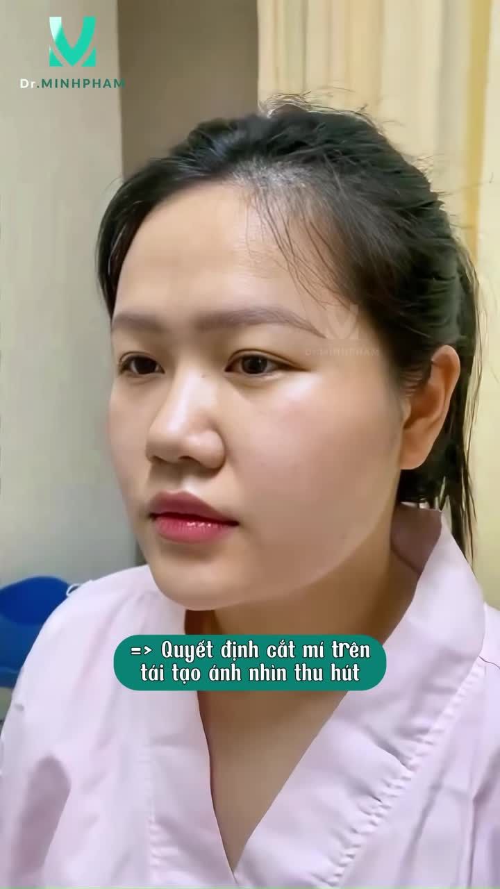 CẮT MÍ – THAY ĐỔI ÁNH NHÌN, NÂNG TẦM NHAN SẮC