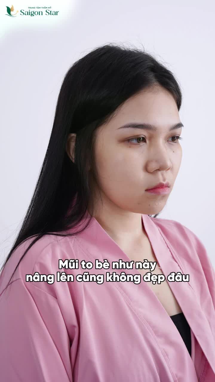 MŨI TO BÈ, THẤP TẸT CỠ NÀO ĐẾN SAIGON STAR 60 PHÚT CÓ NGAY MŨI ĐẸP CAO SANG
