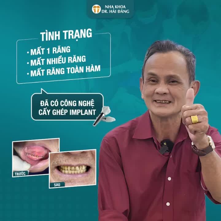 MẤT RĂNG LÂU NĂM - ĂN NHAI KHÓ- GIẢI PHÁP PHỤC HỒI BẤT NGỜ