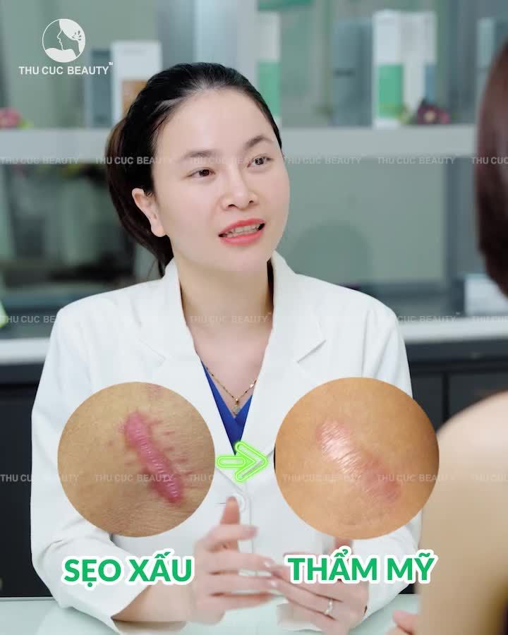 SẸO LỒI CÓ BIẾN MẤT HOÀN TOÀN ĐƯỢC KHÔNG?