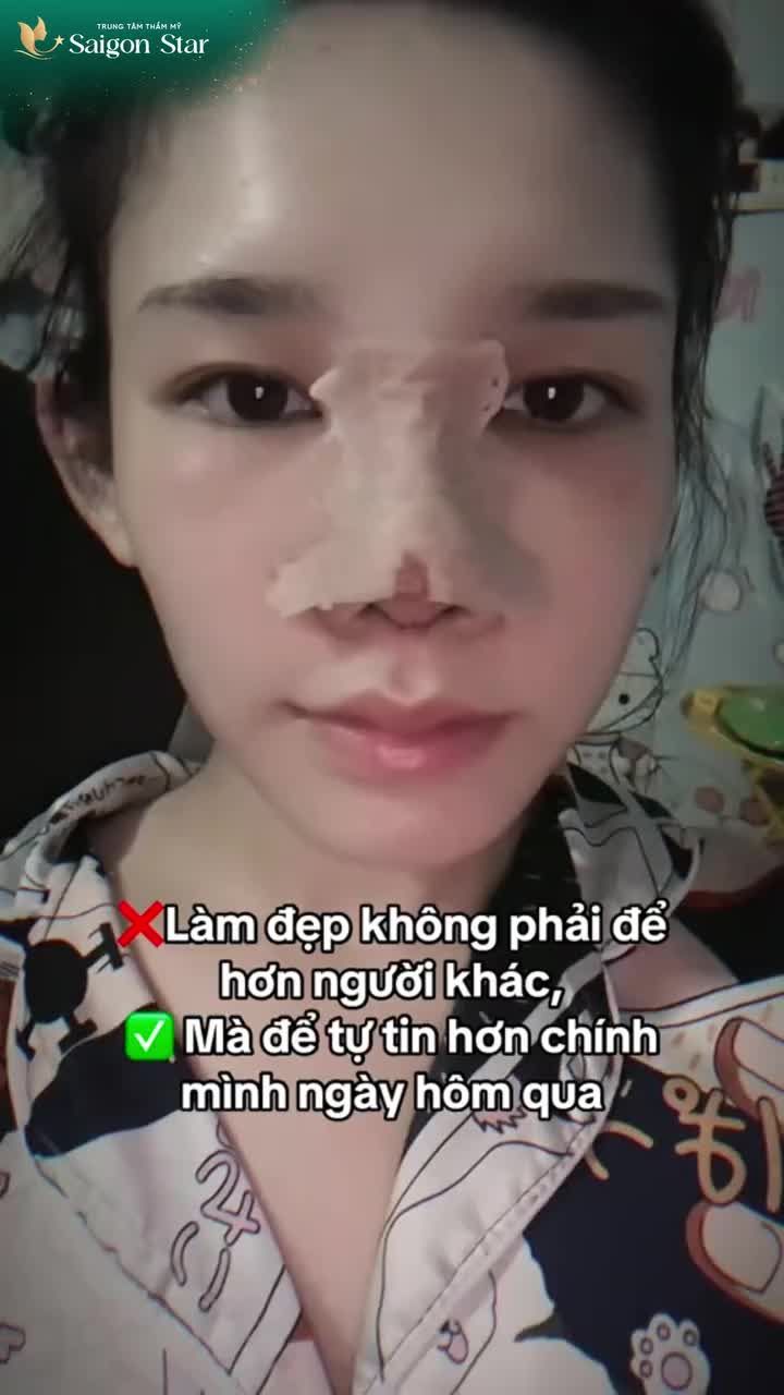 Đây chính là câu trả lời của Thanh Thủy khi được hỏi điều gì khiến Thủy quyết định đi nâng mũi.