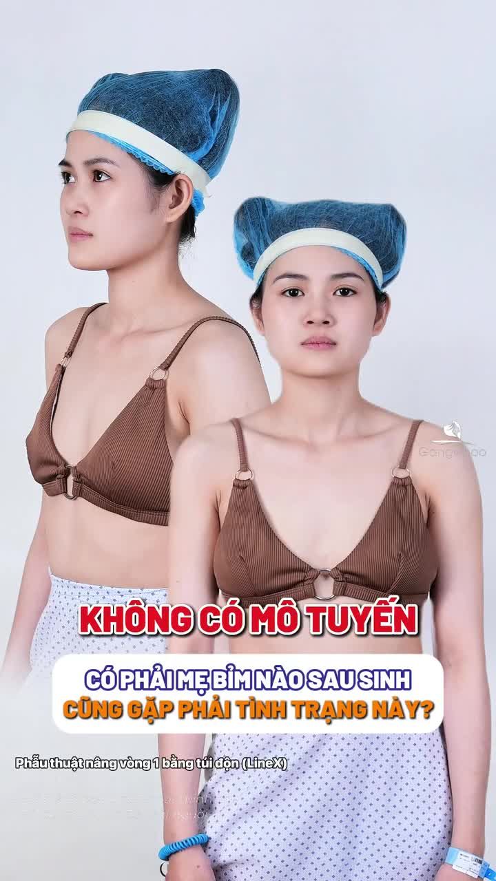 Có phải mẹ bỉm nào sau sinh em bé vòng 1 cũng gặp phải tình trạng như này