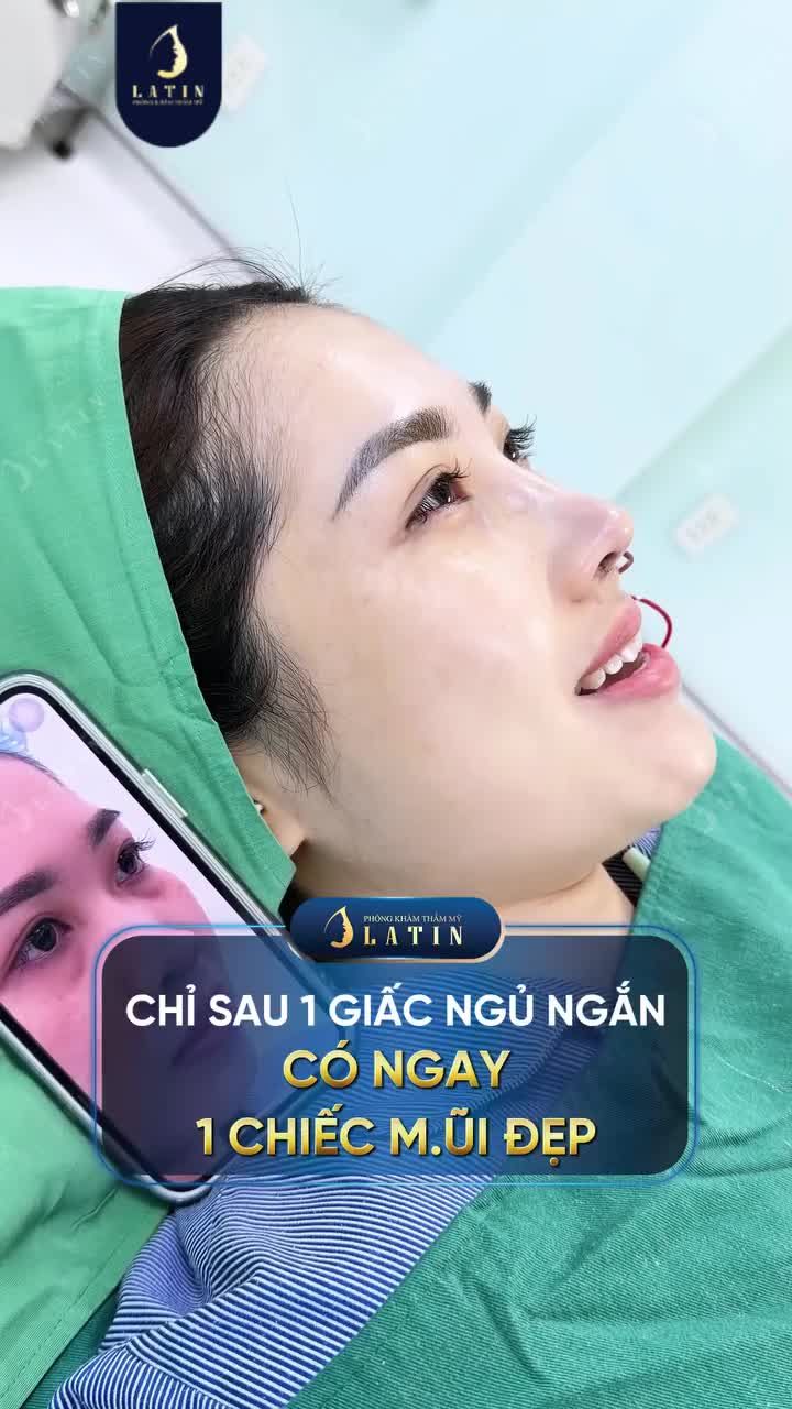 CHỈ SAU 1 GIẤC NGỦ NGẮN - CÓ NGAY 1 CHIẾC MŨI ĐẸP