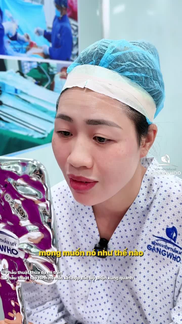 Mong muốn của khách hàng ngày hôm nay khi cắt mí là: Đôi mắt trở nên tươi tắn và rõ nếp mí. Kết quả đã cải thiện rõ rệt chỉ sau gần 1 giờ đồng hồ thực hiện.