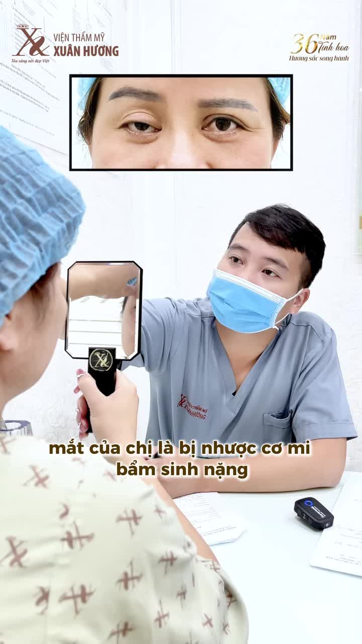 CHỈNH CƠ MI TẠI VIỆN THẨM MỸ XUÂN HƯƠNG