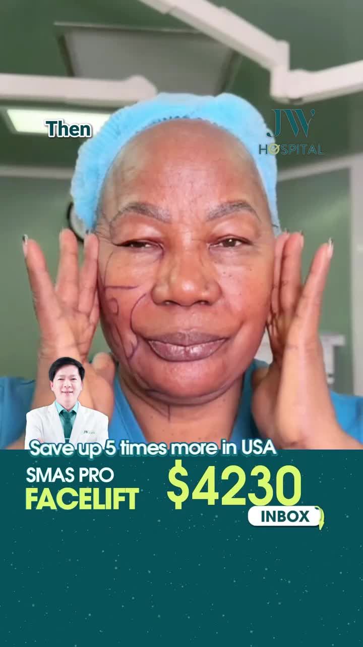 TIẾT KIỆM LÊN ĐẾN 5X SO VỚI MỸ – SMAS PRO FACELIFT TẠI VIỆT NAM TẠI BỆNH VIỆN JW