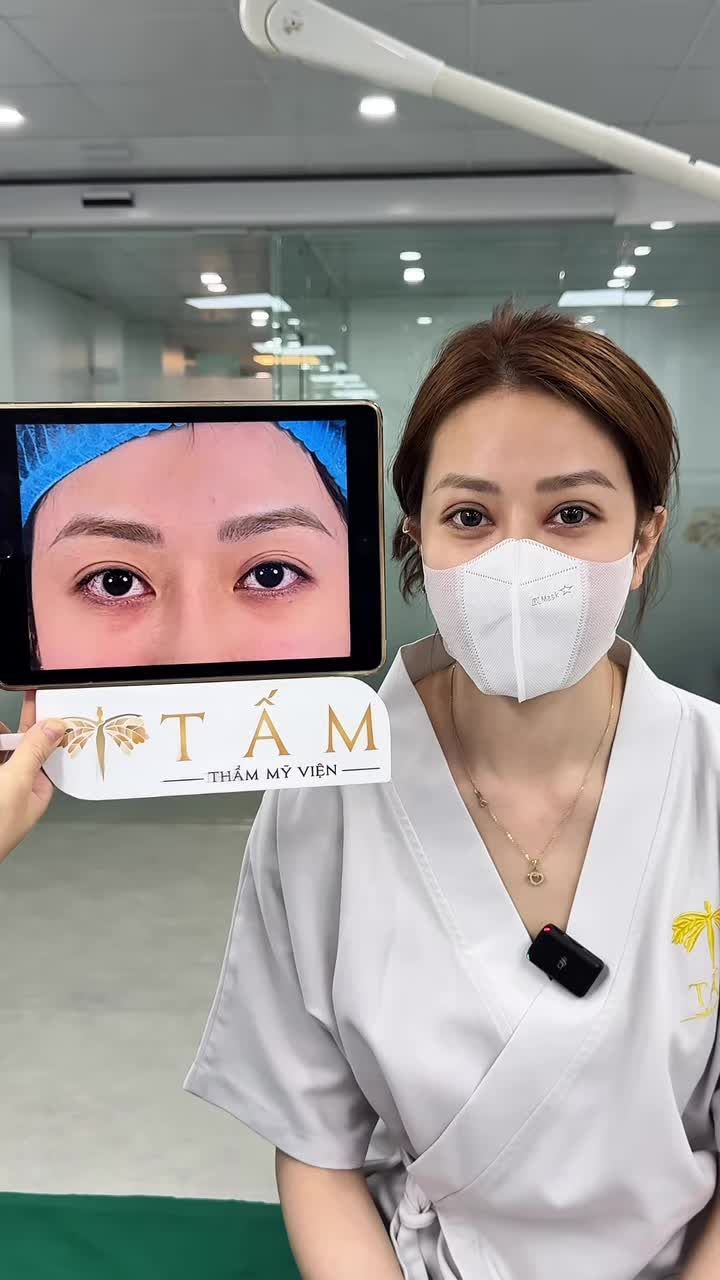 Bạn D chia sẻ: "Nhắc đến cắt mí là nghĩ đến dịch vụ tại Tấm đầu tiên"