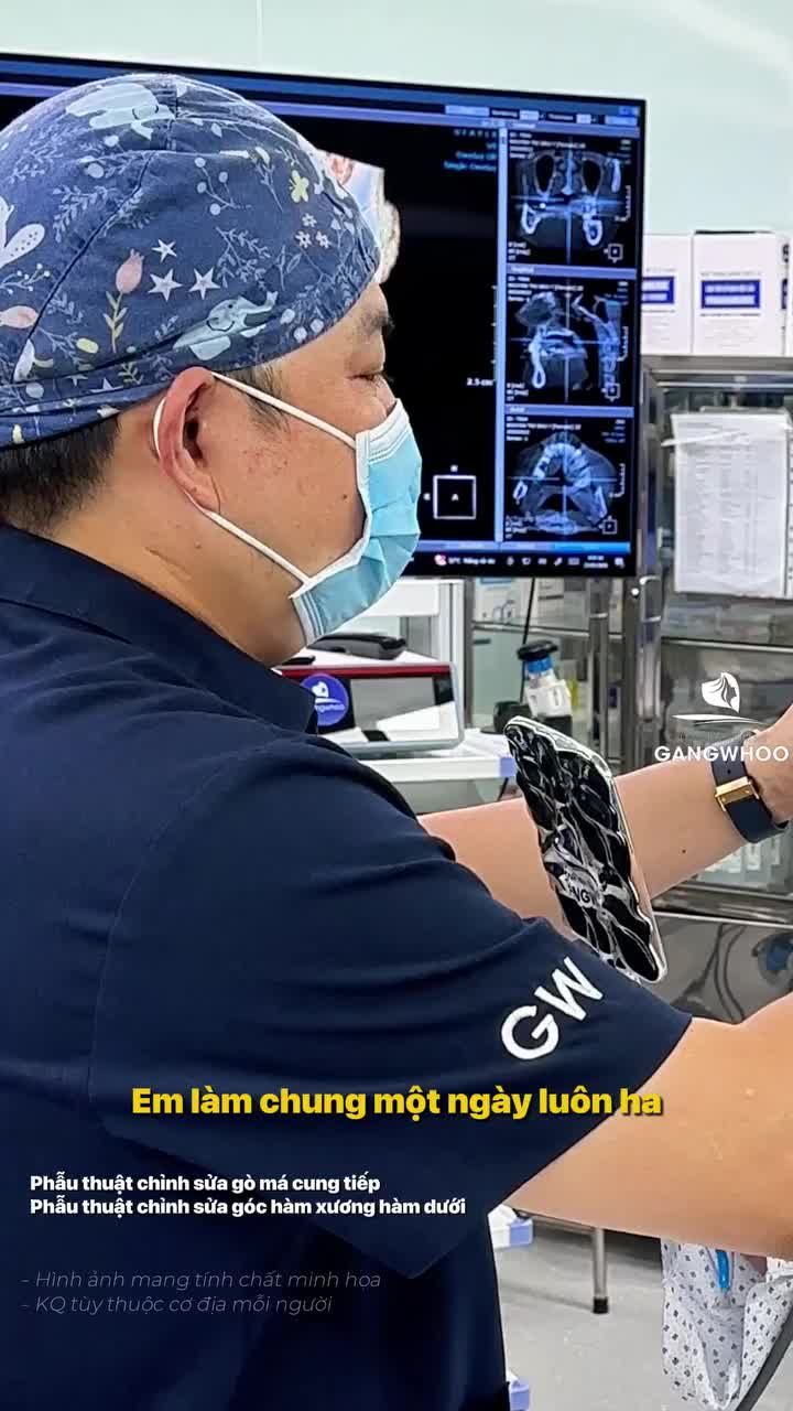 Trải nghiệm thực tế từ bạn nữ với combo hạ gò má kết hợp gọt hàm nội soi 4K