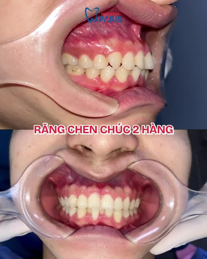 ĐỪNG ĐỂ NGOẠI HÌNH LÀM RÀO CẢN NĂNG LỰC: XEM MÀN LỘT XÁC ĐỔI VẬN CỦA TRỌNG NHÂN!