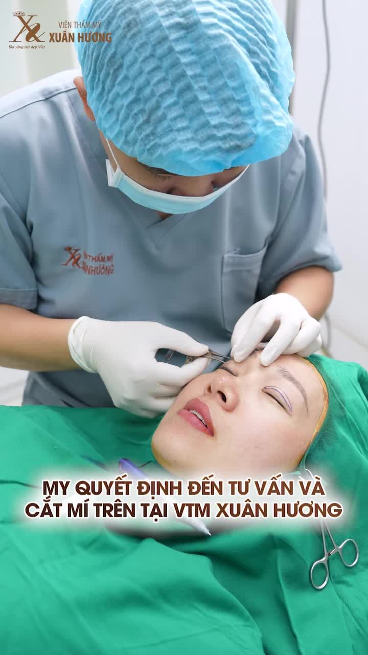 KHÁCH HÀNG FEEDBACK SAU 5 THÁNG CẮT MÍ