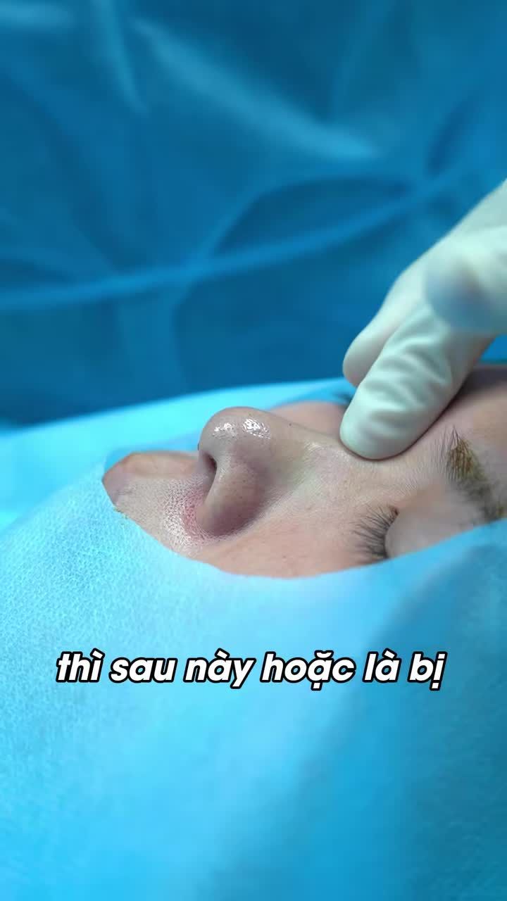 Một ca nâng mũi cấu trúc đẹp không bắt đầu từ việc “làm cao bao nhiêu”…