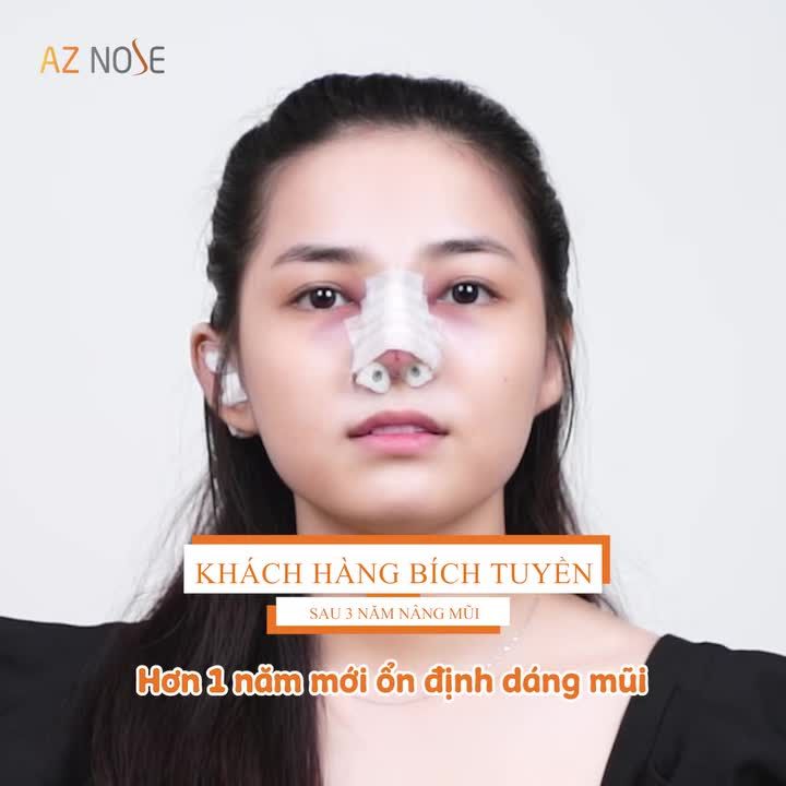 Nhan sắc GenZ ngày càng thăng hạng sau 3 năm nâng mũi tại AZNOSE. Bạn đã có động lực thay đổi chưa?