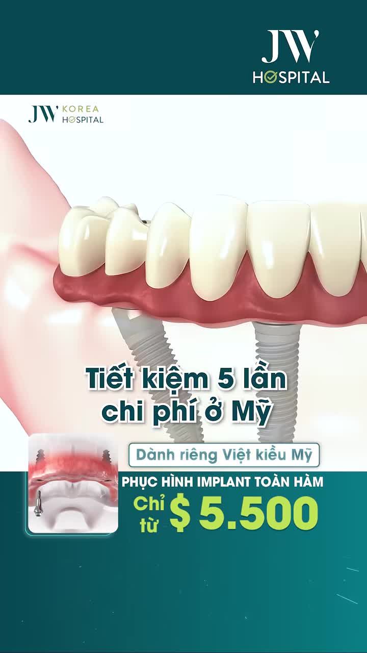 VIỆT KIỀU MỸ 50-80 TUỔI MẤT RĂNG PHẢI BIẾT!! PHỤC HÌNH IMPLANT TOÀN HÀM TẠI JW TIẾT KIỆM GẤP 5 LẦN SO VỚI MỸ?