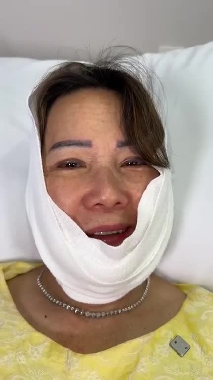 HOT: Bà ngoại U70 Việt kiều Mỹ đến JW CĂNG DA MẶT, XÓA CAU MÀY, CẤY MỠ TRÁN trẻ liền 20 tuổi với COMBO CẢI LÃO