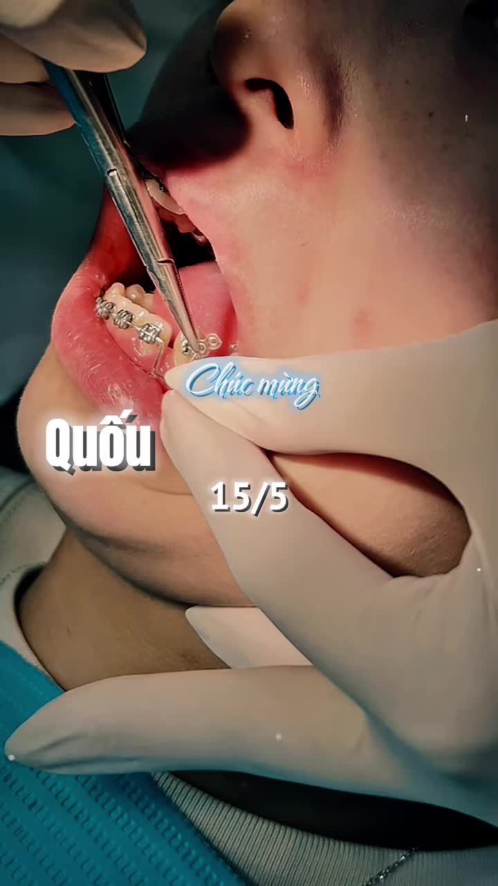 Niềng răng không chỉ là làm đều răng Mà còn là hành trình thay đổi nụ cười, sự tự tin và cả chất lượng cuộc sống.