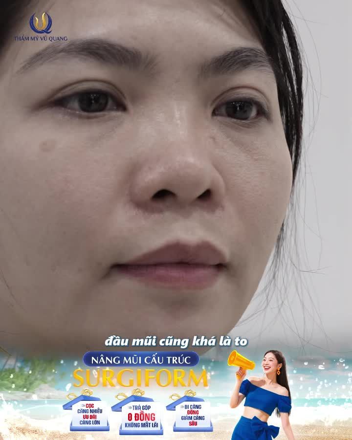 Đặc biệt là với chị em sau sinh khi gương mặt có nhiều thay đổi
