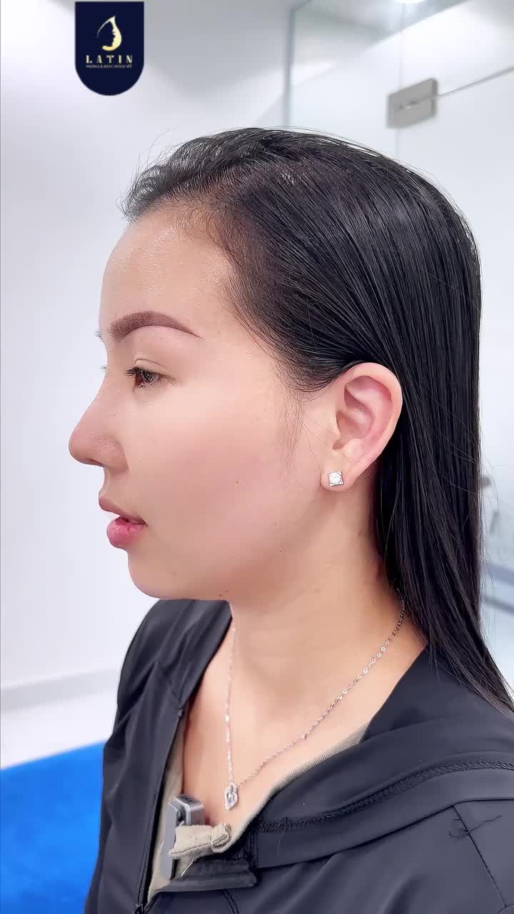 MŨI 1 THÁNG 7 NGÀY MÀ AI GẶP CŨNG KHEN