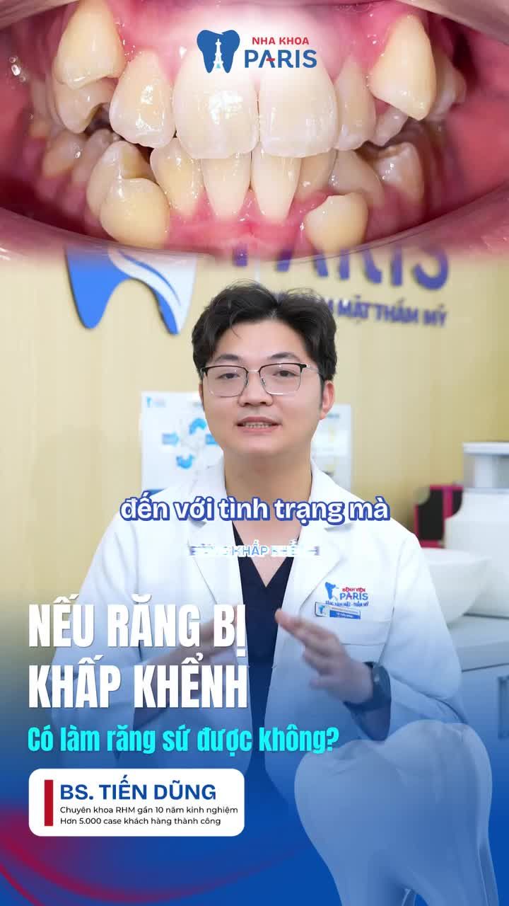 RĂNG KHẤP KHỂNH NIỀNG HAY LÀM SỨ ĐỂ ĐẸP MÀ KHÔNG HẠI RĂNG?