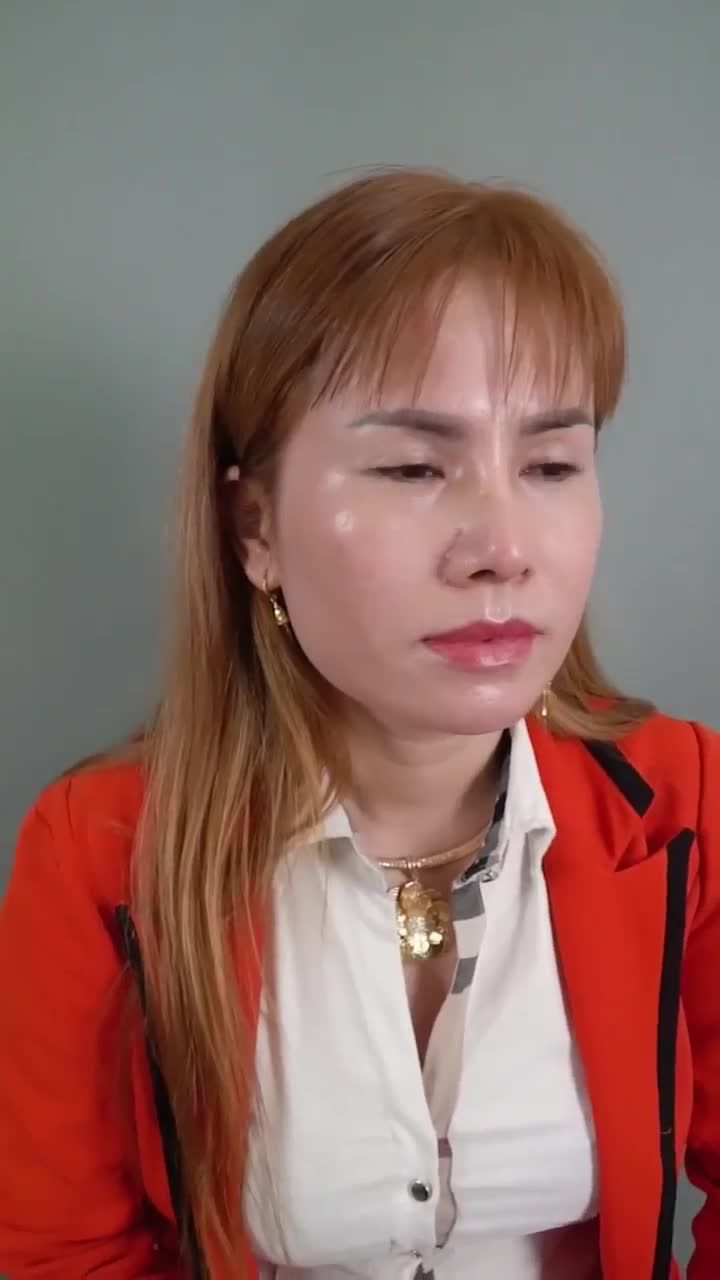 SỰ THAY ĐỔI SAU 10 NGÀY NÂNG MŨI CẤU TRÚC DR. HOẠT