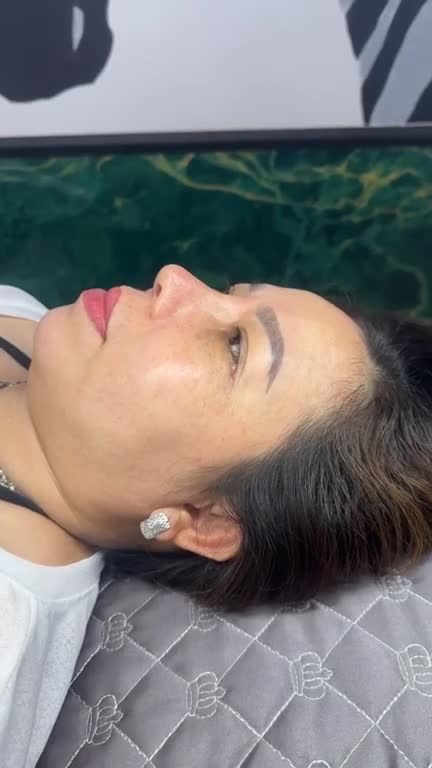 COMBO MŨI TÁI CẤU TRÚC + MIDFACE – NÂNG TẦM NHAN SẮC TOÀN DIỆN