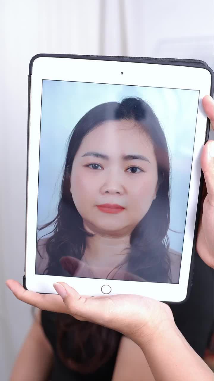 9 NGÀY NÂNG MŨI CẤU TRÚC DR. HOẠT