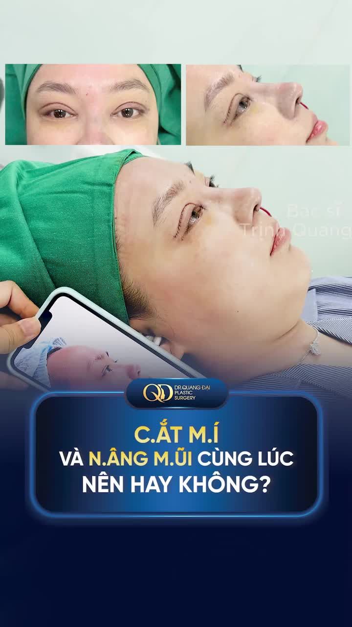 CẮT MÍ VÀ NÂNG MŨI CÙNG LÚC NÊN HAY KHÔNG?