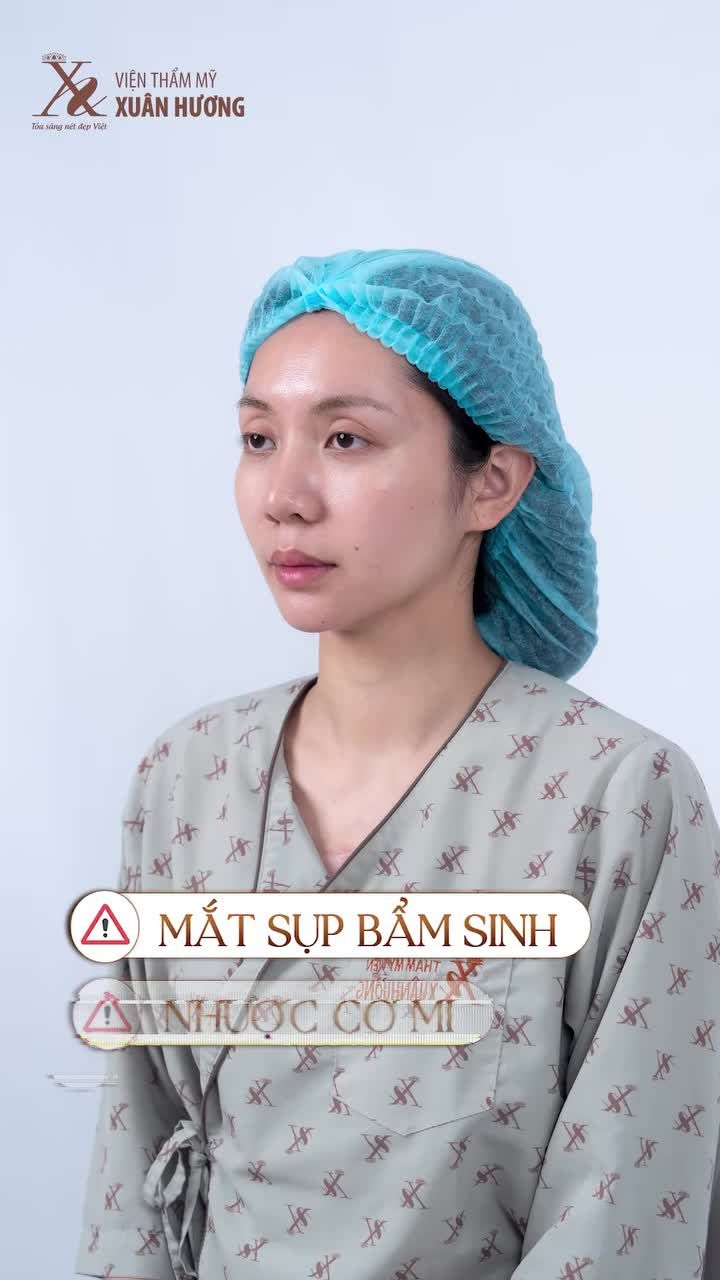 THĂNG HẠNG NHAN SẮC CHỈ VỚI 45 PHÚT CẮT MÍ CHỈNH CƠ MI