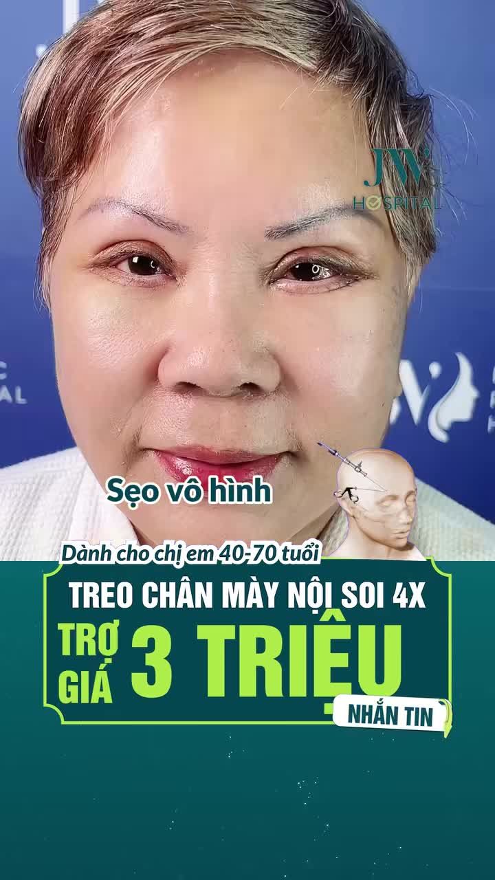 ƯU TIÊN U40-U70: TREO CHÂN MÀY NỘI SOI 4X TRẺ 20 TUỔI, SẸO VÔ HÌNH