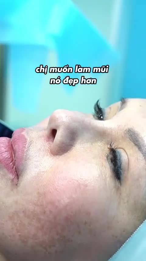 Ai từng làm mũi Silicone có chân rồi chắc sẽ hiểu cảm giác mũi cứng và dễ lộ sụn