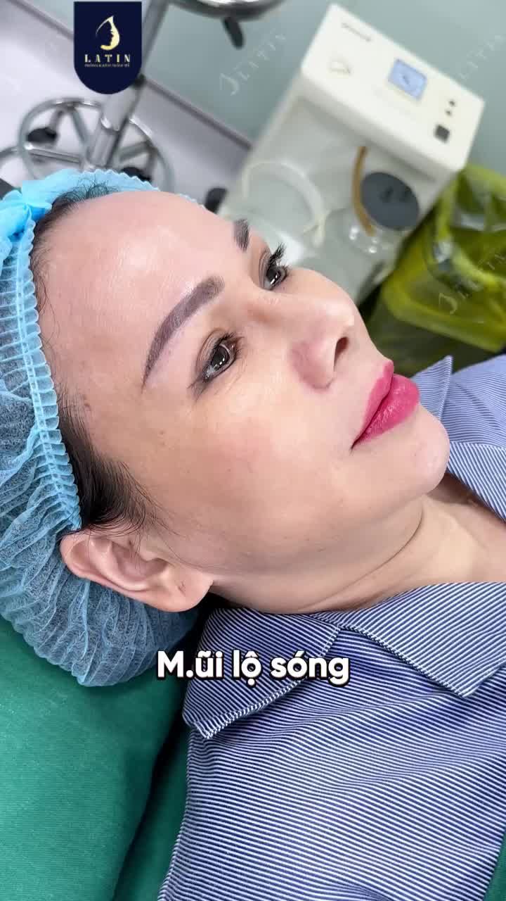 KHI ĐÃ LÀM MŨI NHƯNG CHƯA ƯNG Ý THÌ