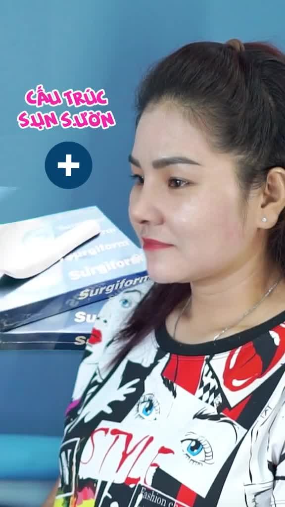 Từng làm mũi ở cả 2 nước nhưng cuối cùng chị vẫn quyết định chỉnh lại dù bs cũng nhận định dáng cũ khá ổn rồi đó nha.