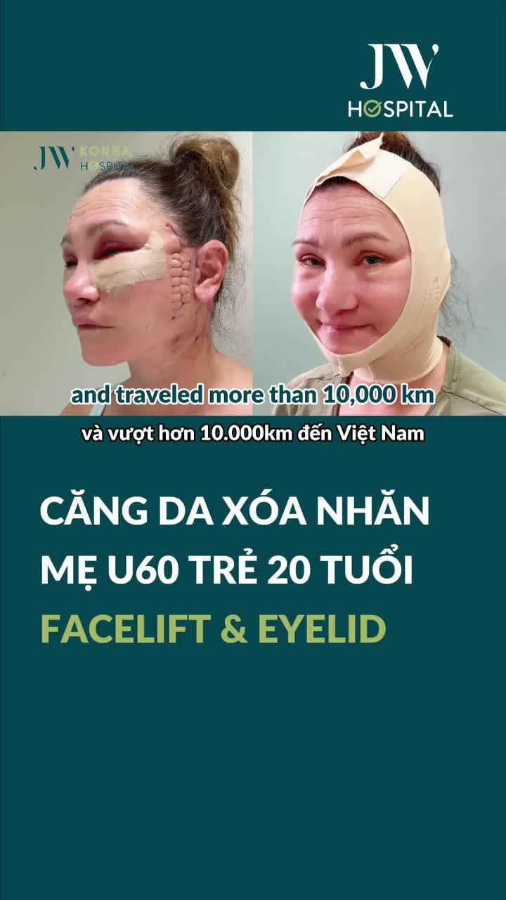 NGỠ NGÀNG MẸ NGƯỜI ÚC U70 CHI MẠNH 200 TRIỆU ĐẾN GẶP BÁC SĨ TÚ DUNG CĂNG DA XÓA NHĂN TRẺ NHƯ CON GÁI