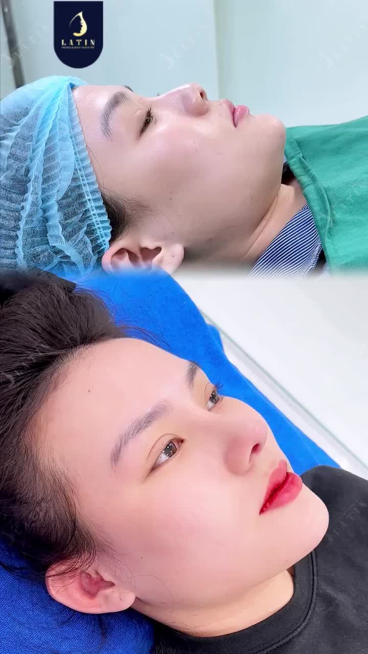 HAI KHOẢNH KHẮC NÀY CÁCH NHAU BAO LÂU?