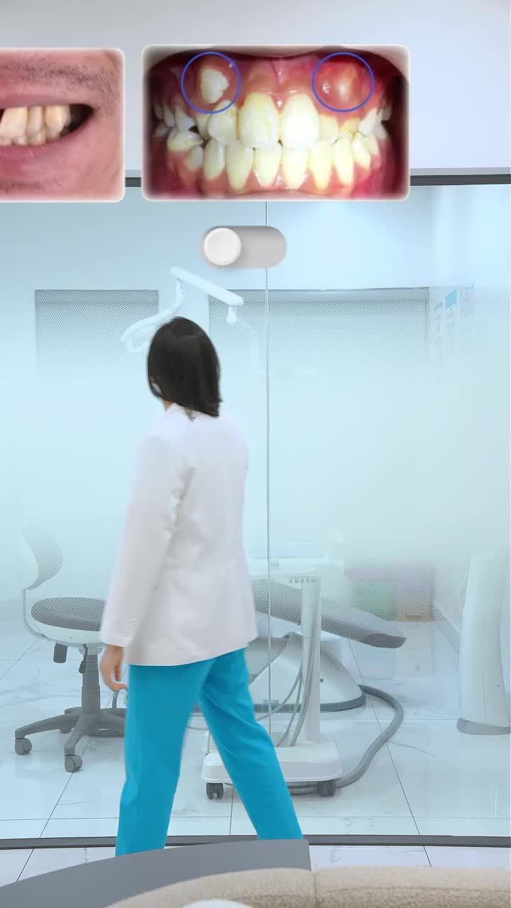 Nhìn lại hành trình "upgrade" nụ cười tại Peace Dentistry. Từ răng chen chúc, lệch lạc đến hàm răng đều, chuẩn khớp cắn.