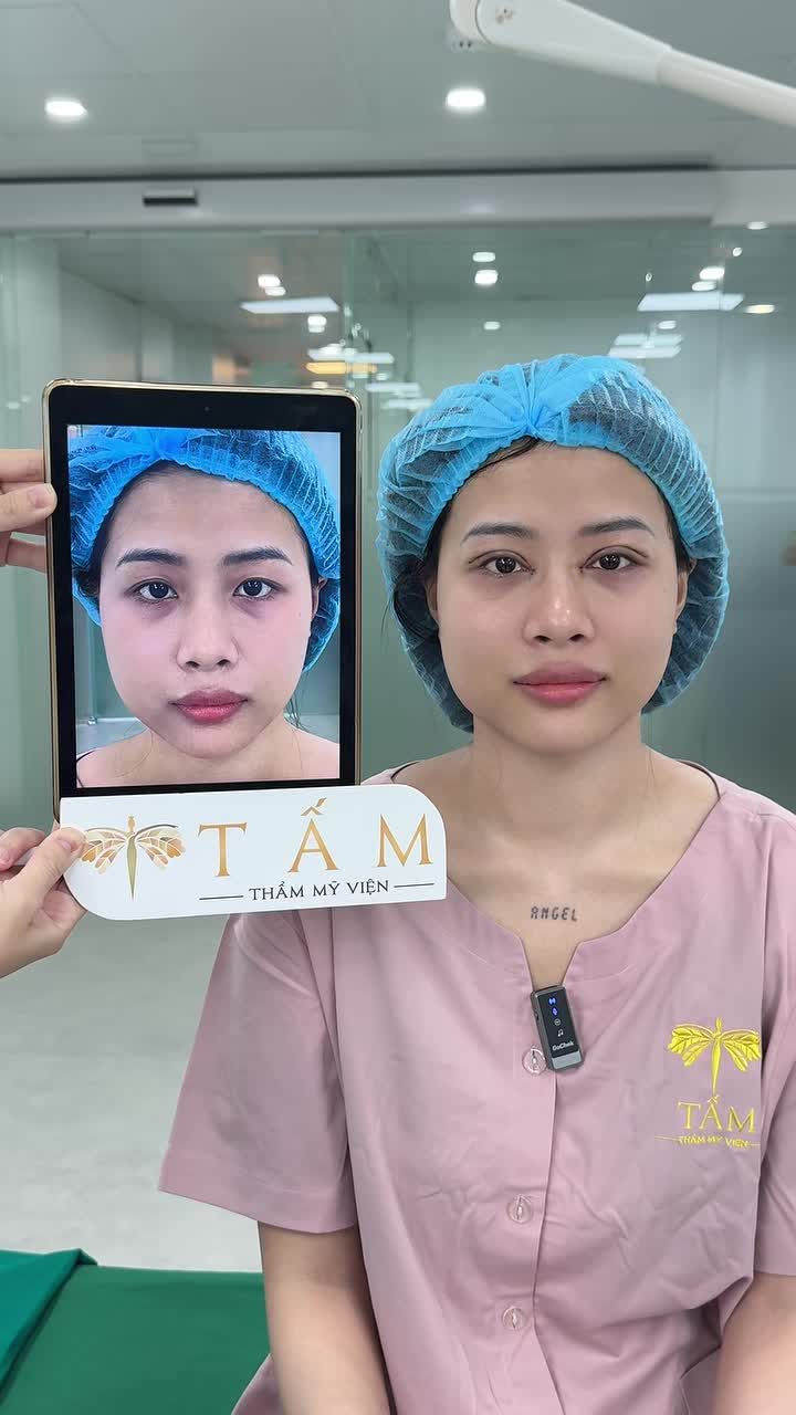 Vượt qua nỗi sợ đau để đổi lấy phiên bản xinh đẹp hơn của chính mình