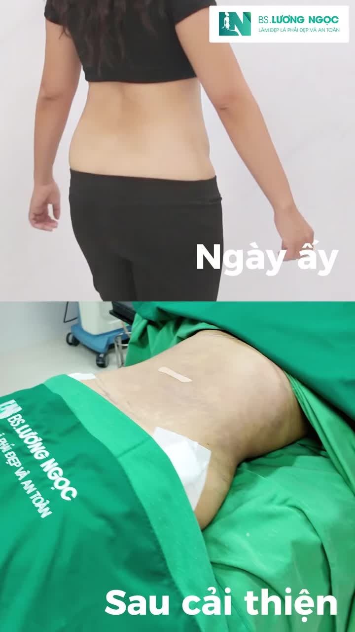 Không phải ai cũng cần cùng một phương pháp.