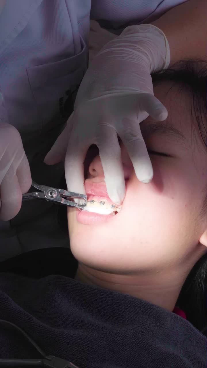 CẬN CẢNH QUÁ TRÌNH THÁO MẮC CÀI NIỀNG RĂNG CHO BẠN KHÁCH HÀNG