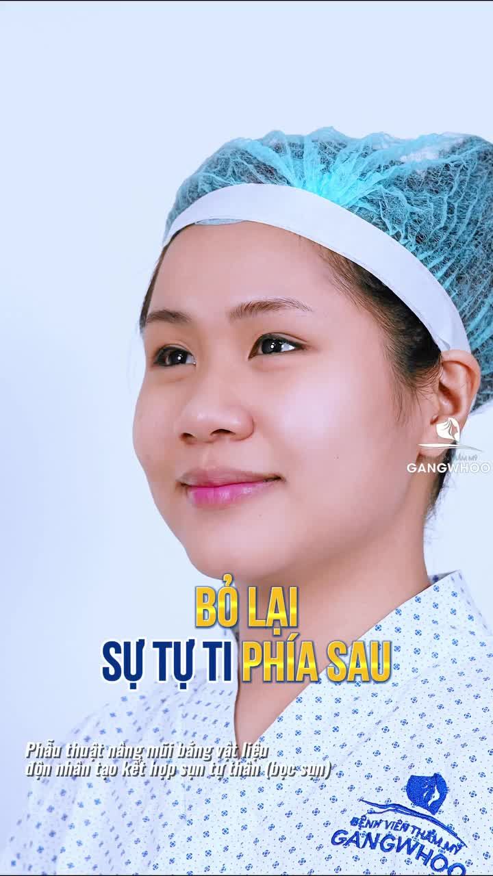 Chào đón phiên bản mới hoàn hảo sau 2 năm nâng mũi