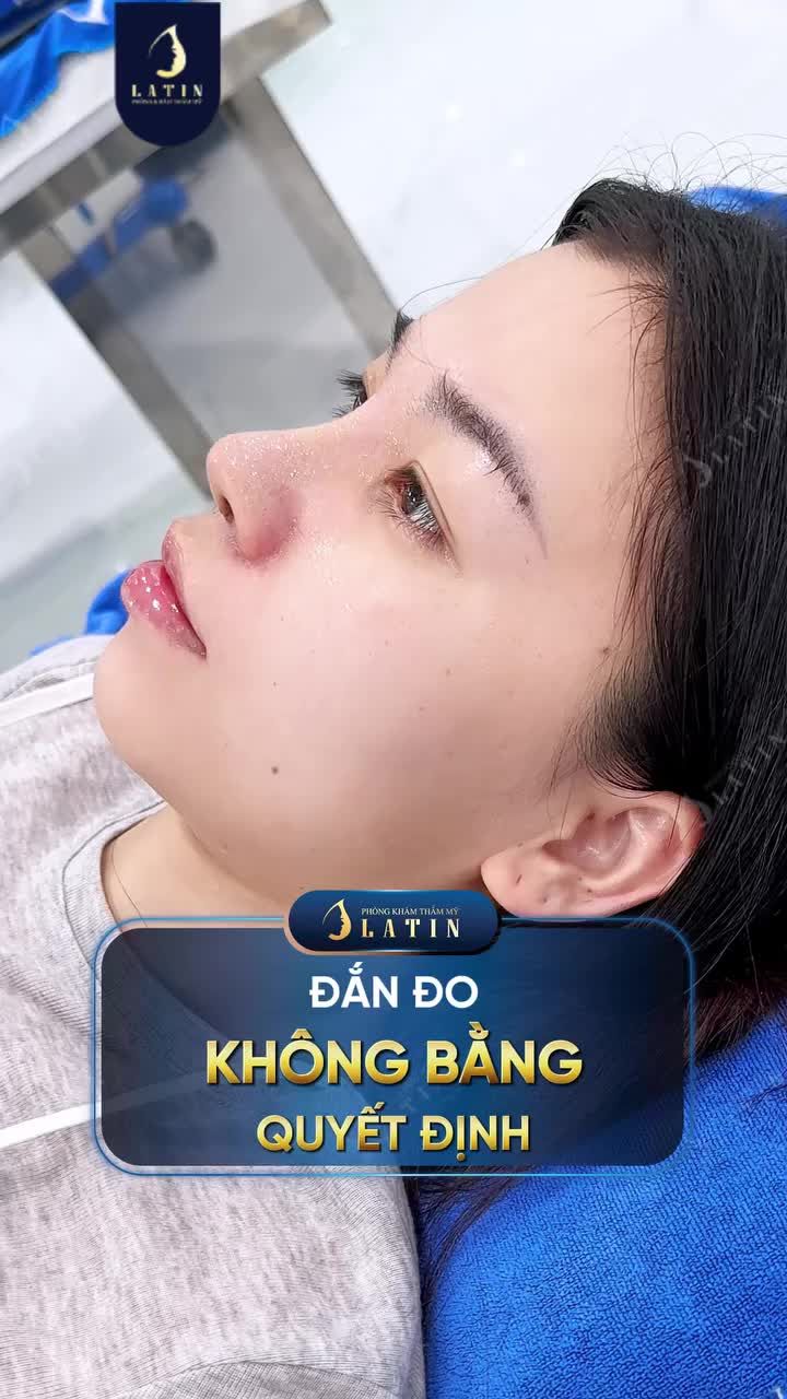 ĐẮN ĐO KHÔNG BẰNG QUYẾT ĐỊNH