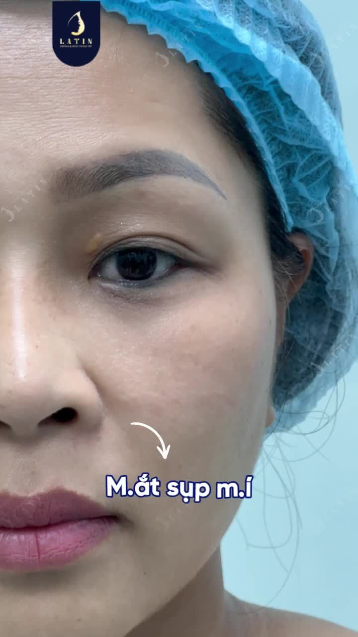 ĐỪNG ĐỂ ĐÔI MẮT KHIẾN ÁNH NHÌN U BUỒN