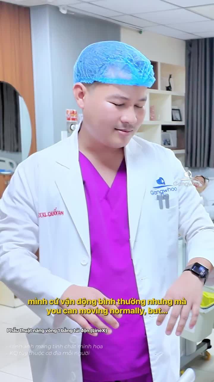 Nâng vòng 1 sau bao lâu thì có thể vận động mạnh?