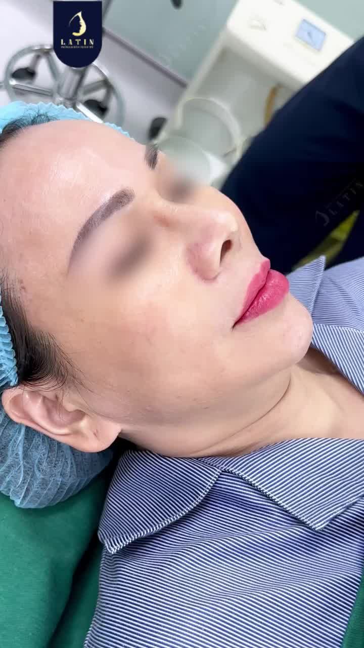 NẾU ĐÃ LÀM MŨI RỒI MÀ VẪN CHƯA  RỰC RỠ THÌ SAO?